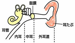 滲出性中耳炎